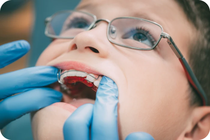 Enfant portant un appareil orthodontique amovible lors d’un contrôle