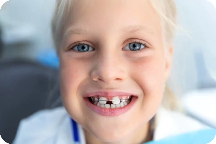 Enfant souriant pendant une phase de surveillance orthodontique de la dentition