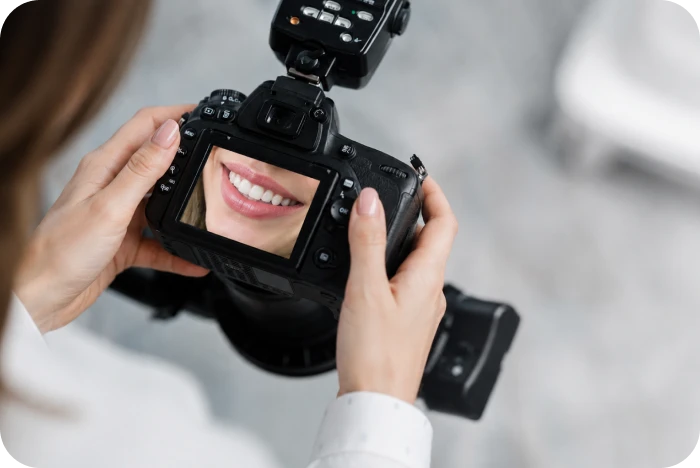 Photographie du sourire réalisée dans le cadre d’un bilan orthodontique